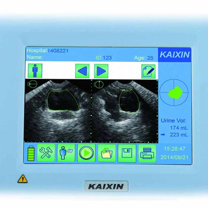 Kaixin BVT01 Bladder Scanner with Touch Screen and Printer